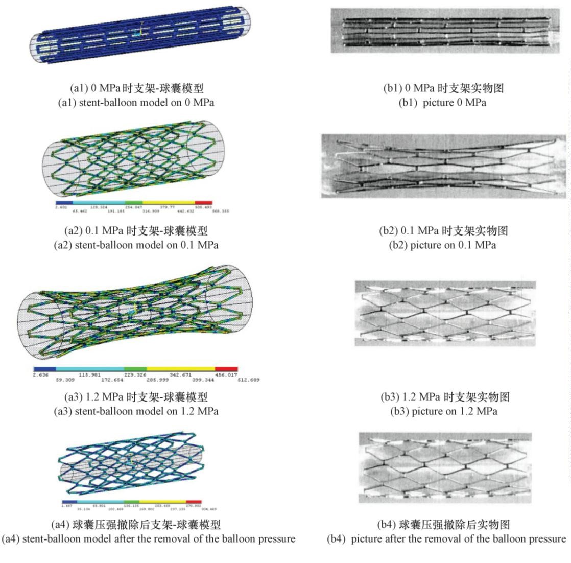 医用血管支架的形变有限元仿真(图4)