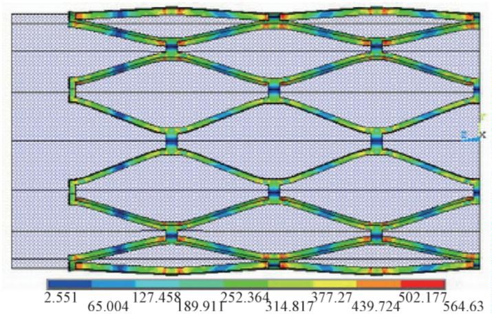 医用血管支架的形变有限元仿真(图2)